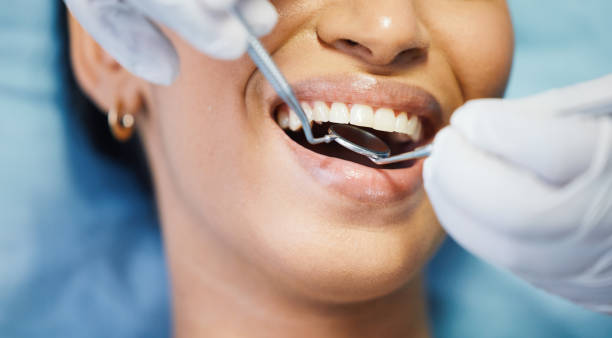Best Emergency Tooth Extraction in Petersburg, WV