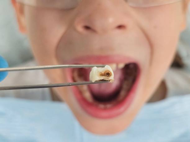 Best Pediatric Emergency Dentist in Petersburg, WV