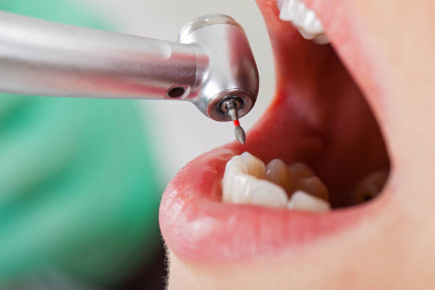 Best Emergency Broken Tooth Repair in Petersburg, WV